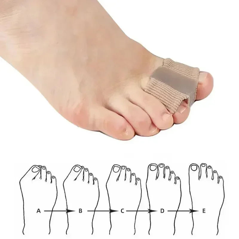Gel Bunion Toe Separator W/Fabric Lining for Big Toe,Silicone Toe Spacers Breathable Toe Corrector Protector for Overlapping Toe