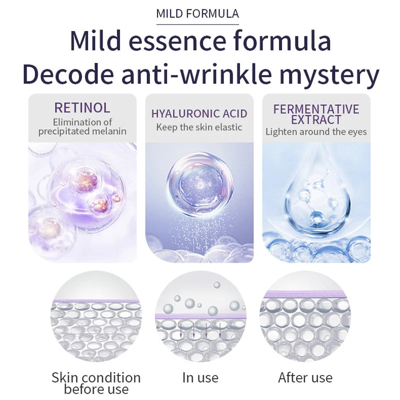 Anti Wrinkle Anti Dark Circle Eye Cream Roller Massager Moisturizing Eye Bags Anti Aging Hyaluronic Acid Eye Skin Care Products