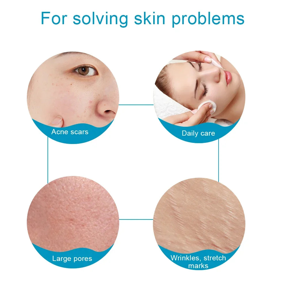 2Pcs Set Multi-function Lymphatic Contour Face Brush & DRS 540 Derma Roller Skin Nursing Roller Wrinkle Exfoliating Repair Tools