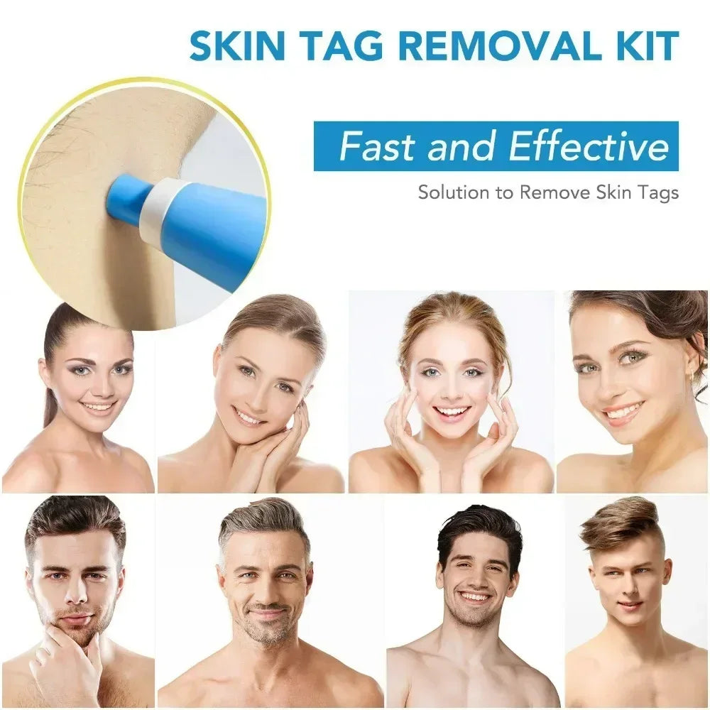 NEW Skin Tags Remover Tool 2-in-1 Auto Fast Removal Kit Safe Auto Tags Removal Pen with Bands 2-8mm Skin Tag Face Skin Care Tool