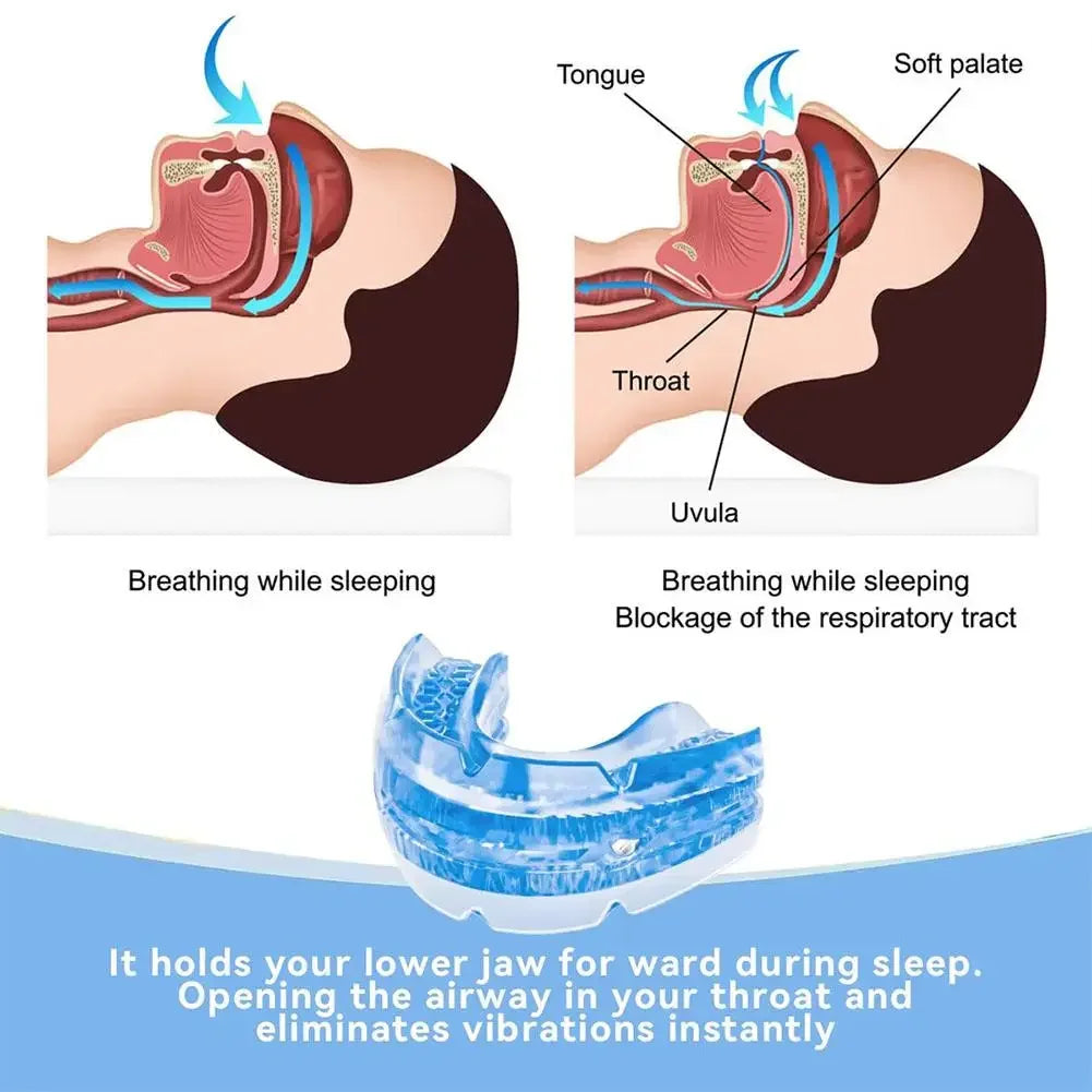 Adjustable Anti Snoring Oral Guard Oral Cover Reduces Temporomandibular Joint Disorders Alleviates Sleep Improves Breathing